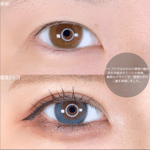 No.9102の症例写真